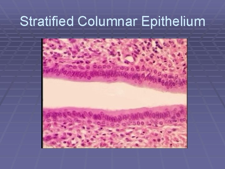Stratified Columnar Epithelium 