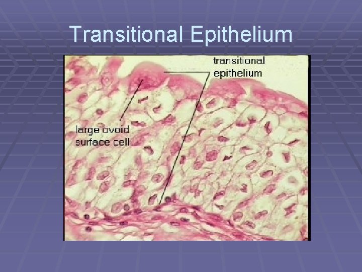 Transitional Epithelium 
