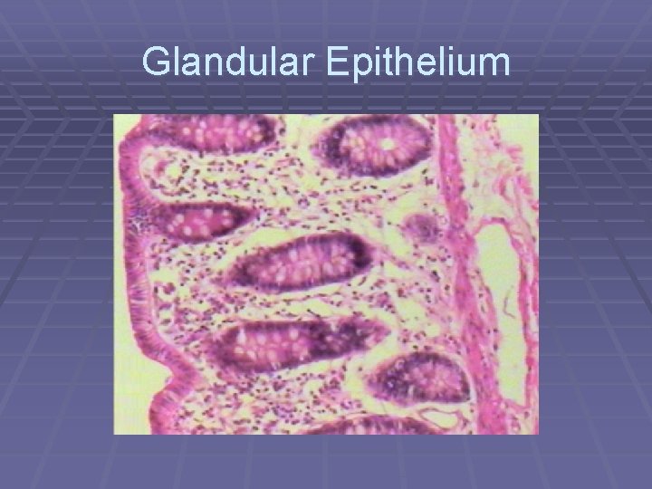 Glandular Epithelium 