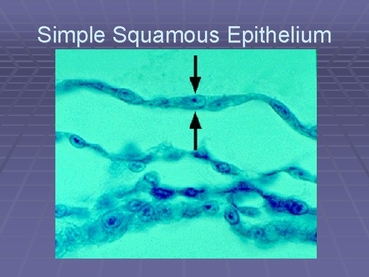 Simple Squamous Epithelium 