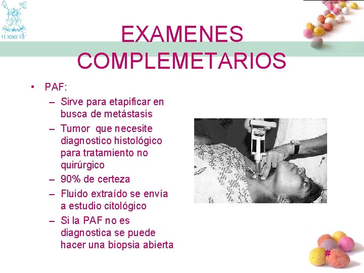 EXAMENES COMPLEMETARIOS • PAF: – Sirve para etapificar en busca de metástasis – Tumor