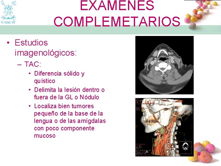 EXAMENES COMPLEMETARIOS • Estudios imagenológicos: – TAC: • Diferencia sólido y quístico • Delimita