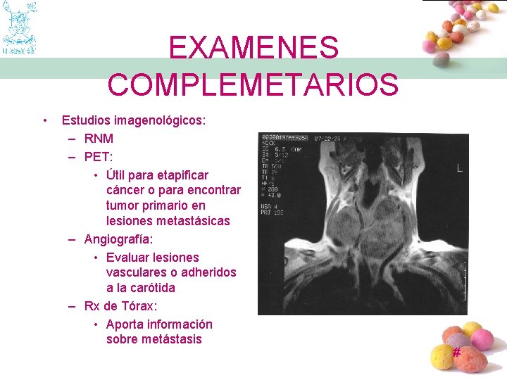 EXAMENES COMPLEMETARIOS • Estudios imagenológicos: – RNM – PET: • Útil para etapificar cáncer