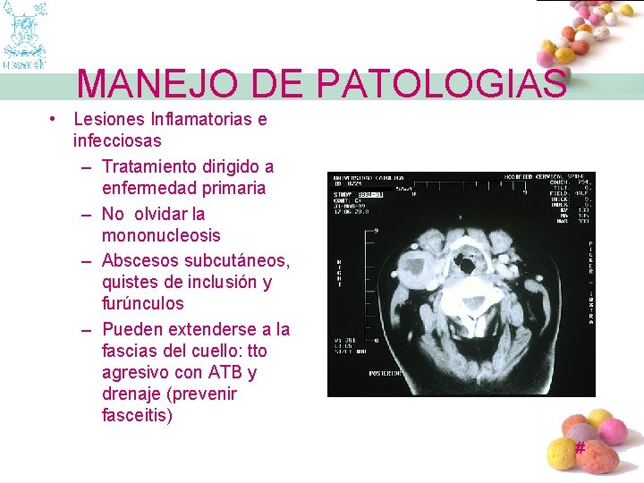 MANEJO DE PATOLOGIAS • Lesiones Inflamatorias e infecciosas – Tratamiento dirigido a enfermedad primaria