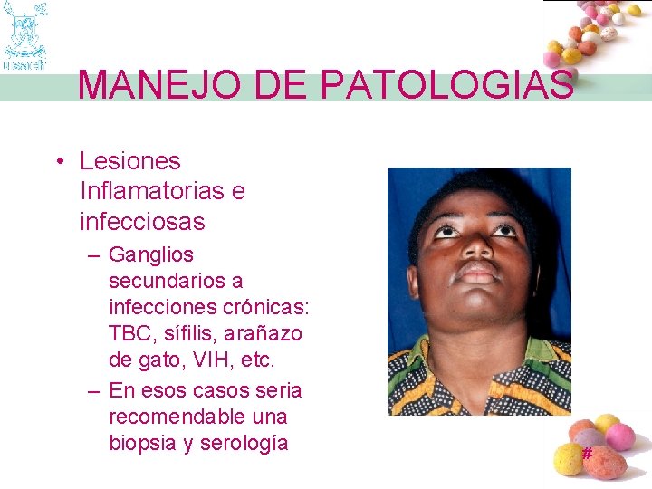 MANEJO DE PATOLOGIAS • Lesiones Inflamatorias e infecciosas – Ganglios secundarios a infecciones crónicas:
