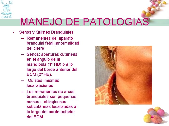 MANEJO DE PATOLOGIAS • Senos y Quistes Branquiales – Remanentes del aparato branquial fetal