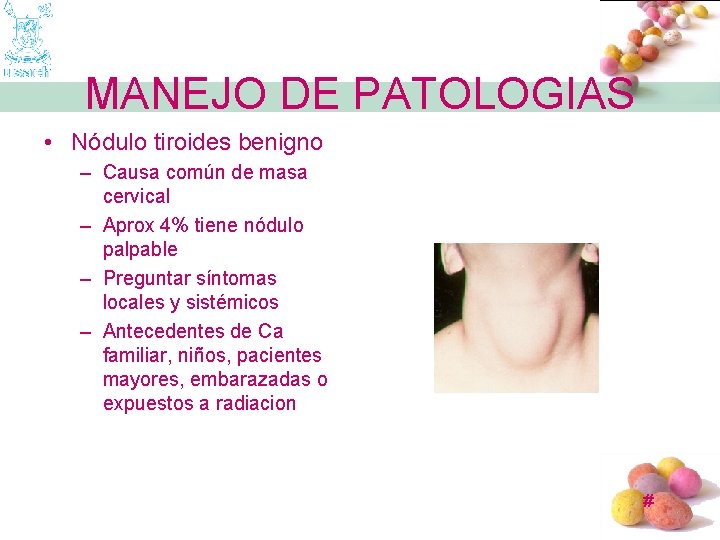 MANEJO DE PATOLOGIAS • Nódulo tiroides benigno – Causa común de masa cervical –