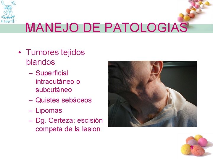 MANEJO DE PATOLOGIAS • Tumores tejidos blandos – Superficial intracutáneo o subcutáneo – Quistes