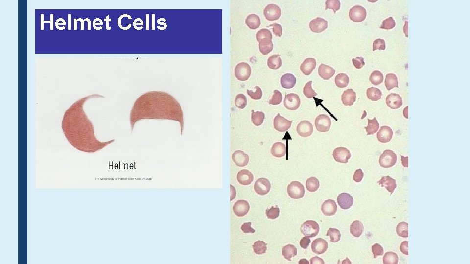 Helmet Cells 