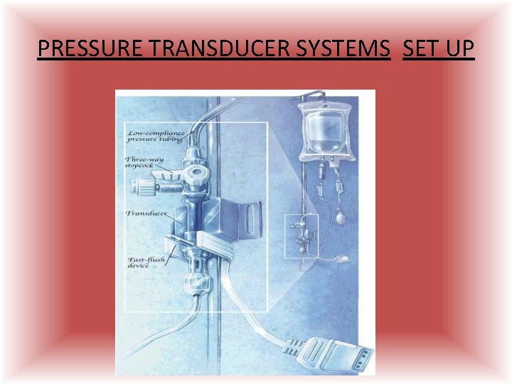 PRESSURE TRANSDUCER SYSTEMS SET UP  PRESSURE TRANSDUCER SYSTEMS SET UP