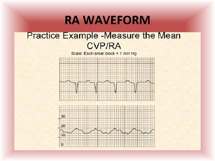 RA WAVEFORM  RA WAVEFORM