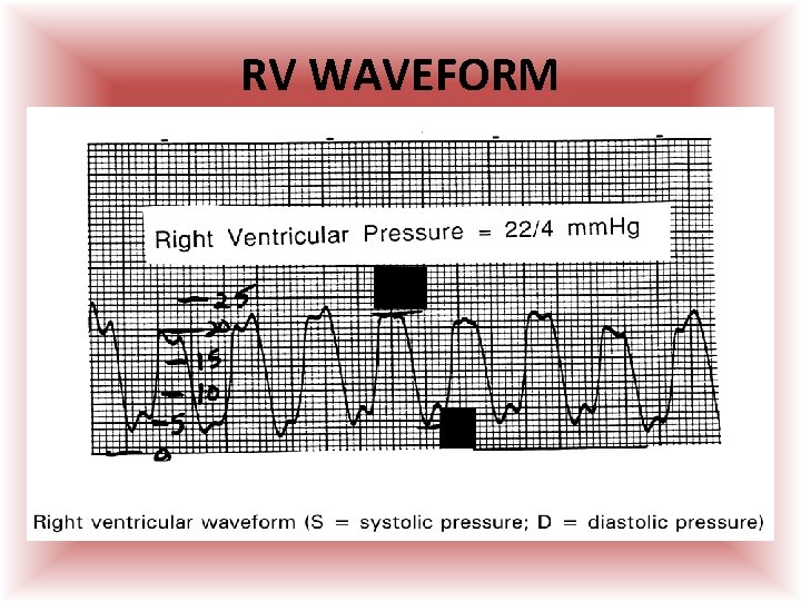 RV WAVEFORM 22 4  RV WAVEFORM 22 4