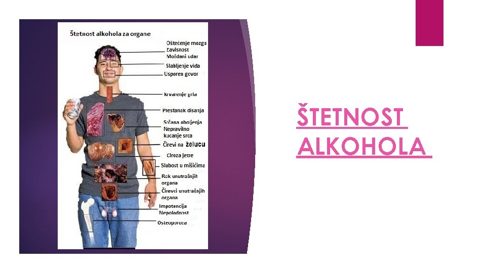 ŠTETNOST ALKOHOLA 