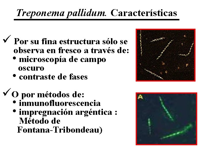 Treponema pallidum. Características ü Por su fina estructura sólo se observa en fresco a