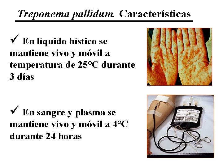 Treponema pallidum. Características ü En líquido hístico se mantiene vivo y móvil a temperatura