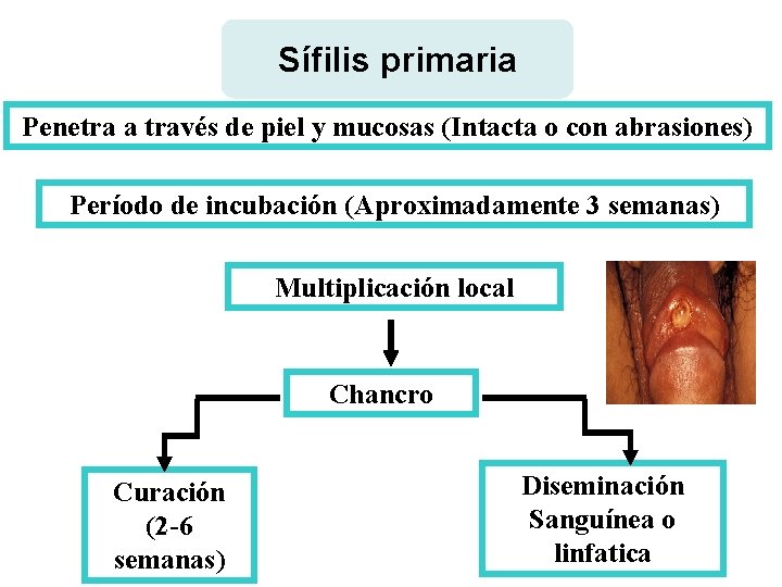 Sífilis primaria Penetra a través de piel y mucosas (Intacta o con abrasiones) Período
