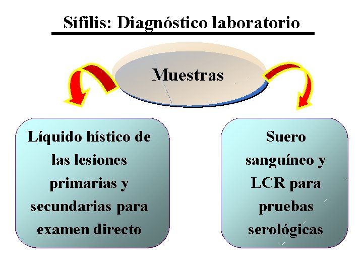Sífilis: Diagnóstico laboratorio Muestras Líquido hístico de las lesiones primarias y secundarias para examen
