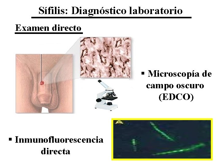 Sífilis: Diagnóstico laboratorio Examen directo § Microscopía de campo oscuro (EDCO) § Inmunofluorescencia directa