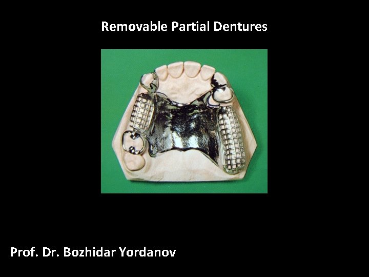 Removable Partial Dentures Prof. Dr. Bozhidar Yordanov 