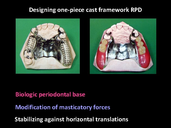 Designing one-piece cast framework RPD Biologic periodontal base Modification of masticatory forces Stabilizing against