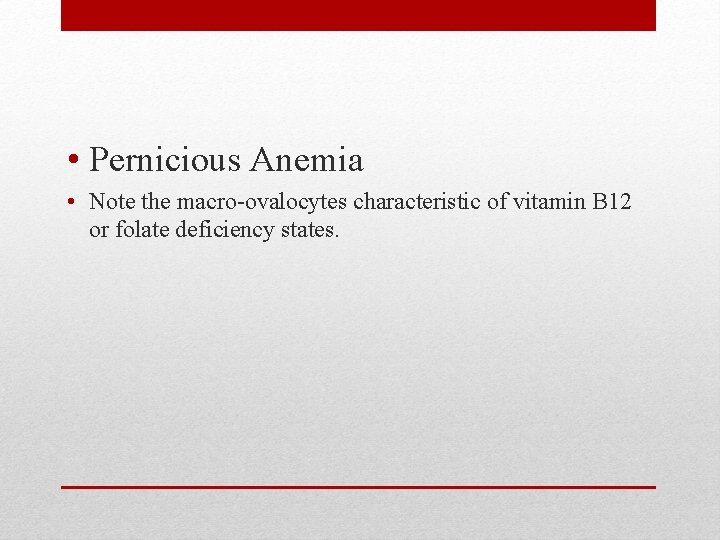  • Pernicious Anemia • Note the macro-ovalocytes characteristic of vitamin B 12 or
