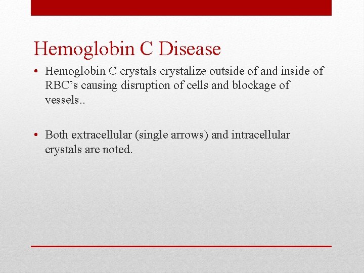 Hemoglobin C Disease • Hemoglobin C crystals crystalize outside of and inside of RBC’s