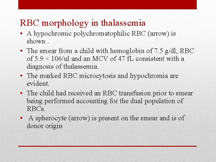 RBC morphology in thalassemia • A hypochromic polychromatophilic RBC (arrow) is shown. • The