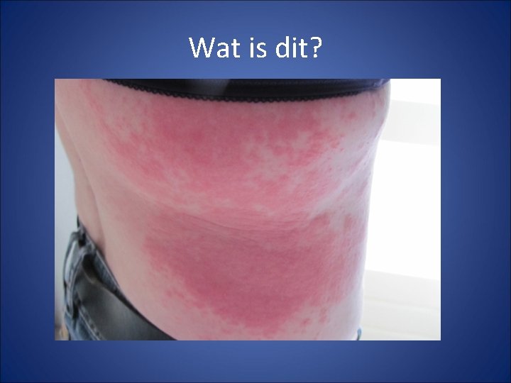 Wat is dit? 