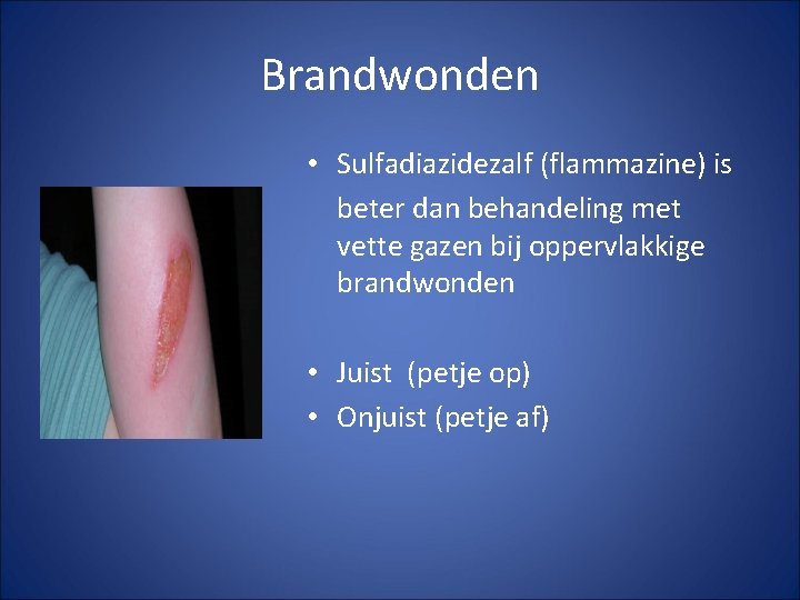 Brandwonden • Sulfadiazidezalf (flammazine) is beter dan behandeling met vette gazen bij oppervlakkige brandwonden