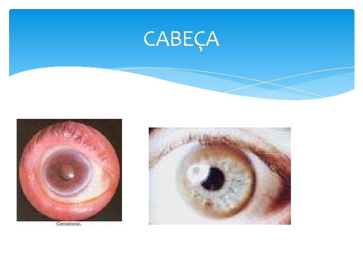 CABEÇA 