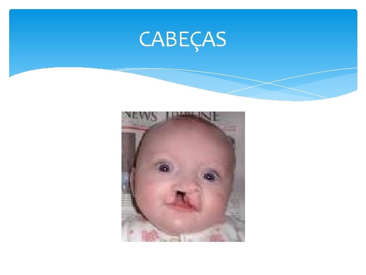 CABEÇAS 