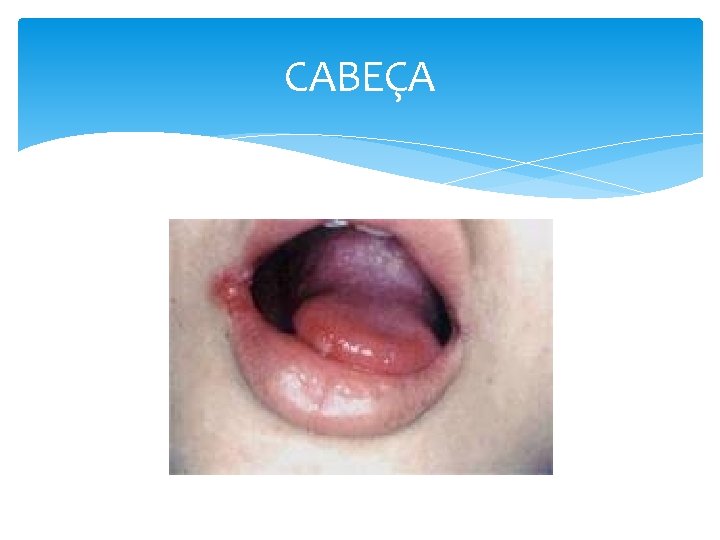 CABEÇA 