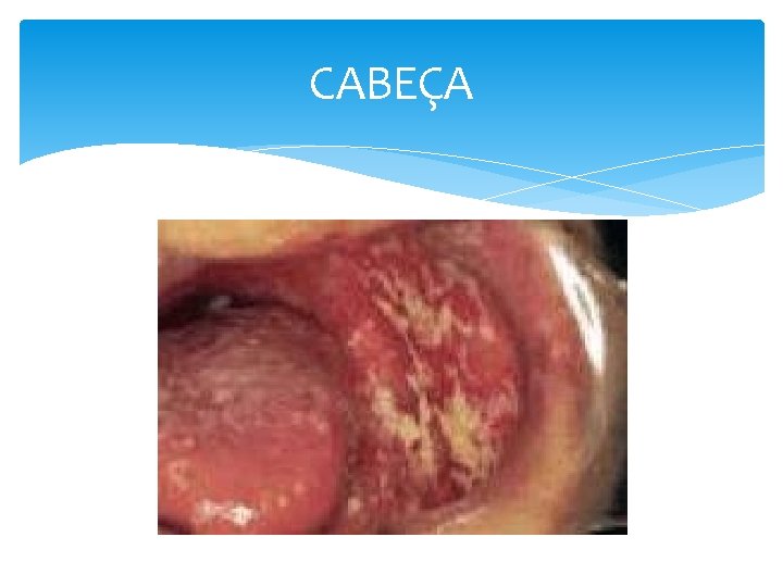 CABEÇA 