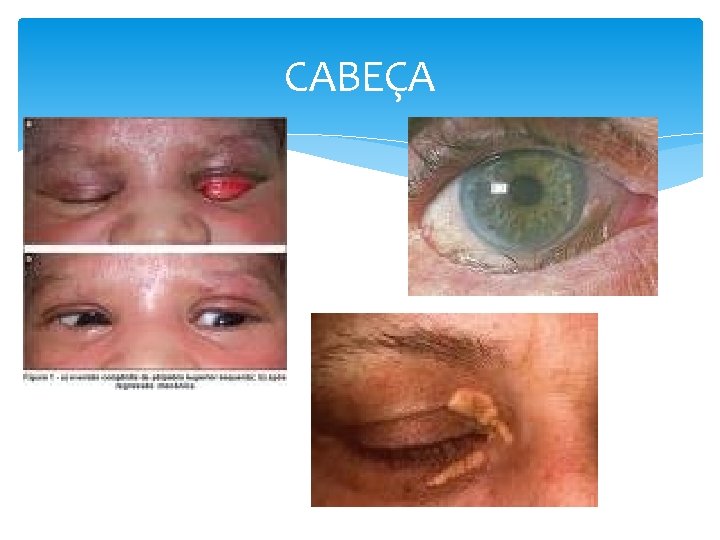 CABEÇA 