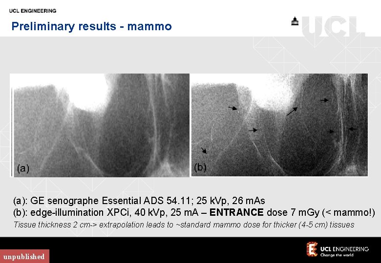 Preliminary results - mammo (a): GE senographe Essential ADS 54. 11; 25 k. Vp,
