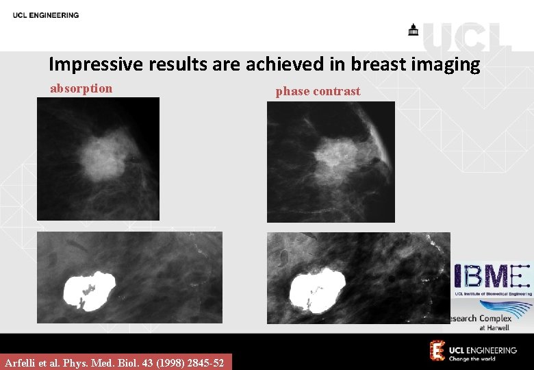 Impressive results are achieved in breast imaging absorption Arfelli et al. Phys. Med. Biol.