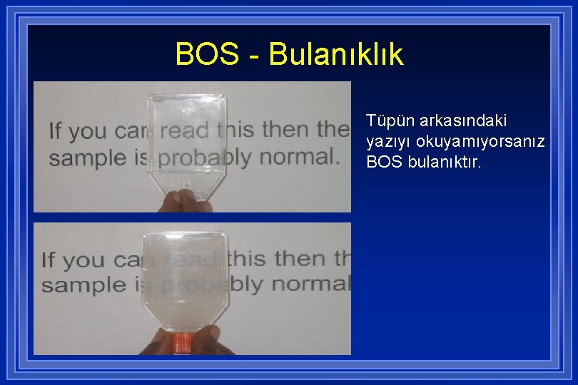 BOS - Bulanıklık Tüpün arkasındaki yazıyı okuyamıyorsanız BOS bulanıktır. 