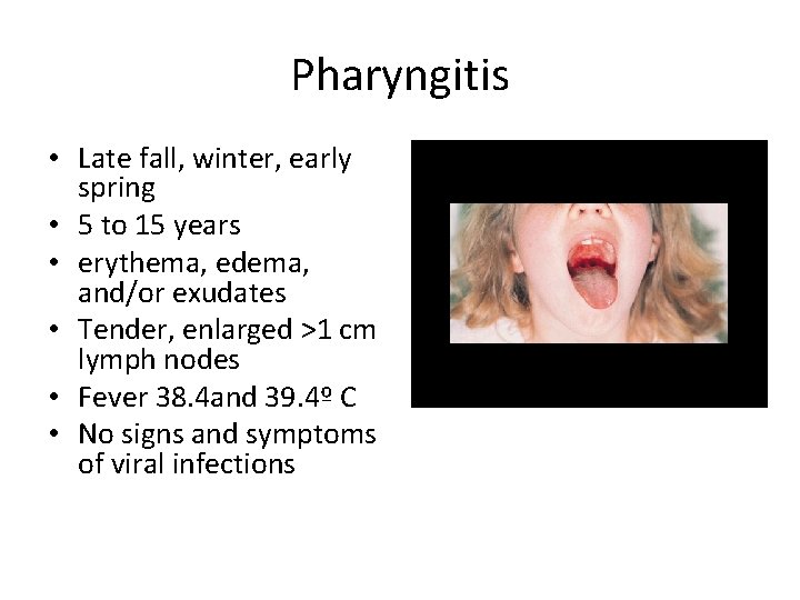 Pharyngitis • Late fall, winter, early spring • 5 to 15 years • erythema,