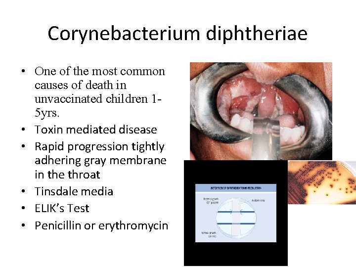 Corynebacterium diphtheriae • One of the most common causes of death in unvaccinated children