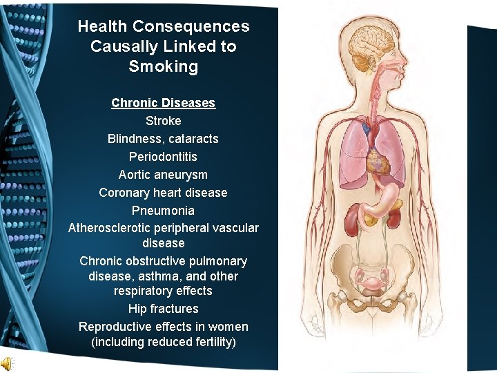 Health Consequences Causally Linked to Smoking Chronic Diseases Stroke Blindness, cataracts Periodontitis Aortic aneurysm