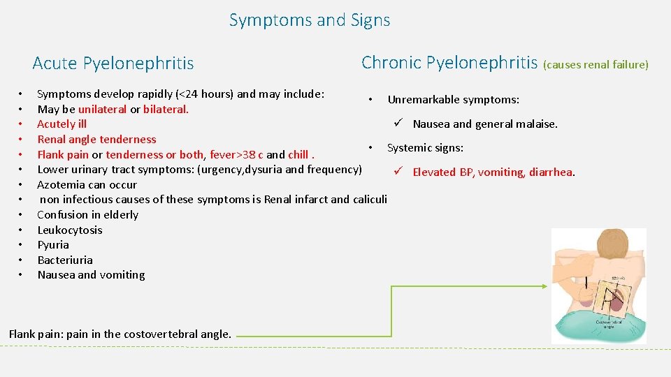 Symptoms and Signs Acute Pyelonephritis • • • • Chronic Pyelonephritis (causes renal failure)