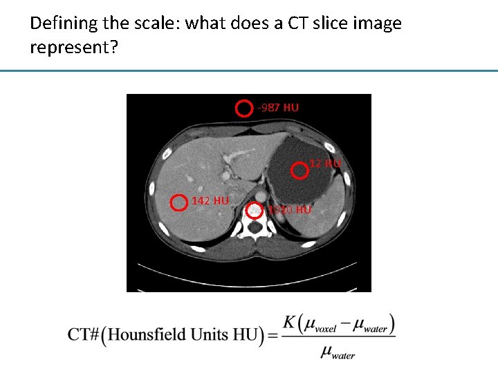 Defining the scale: what does a CT slice image represent? -987 HU 12 HU