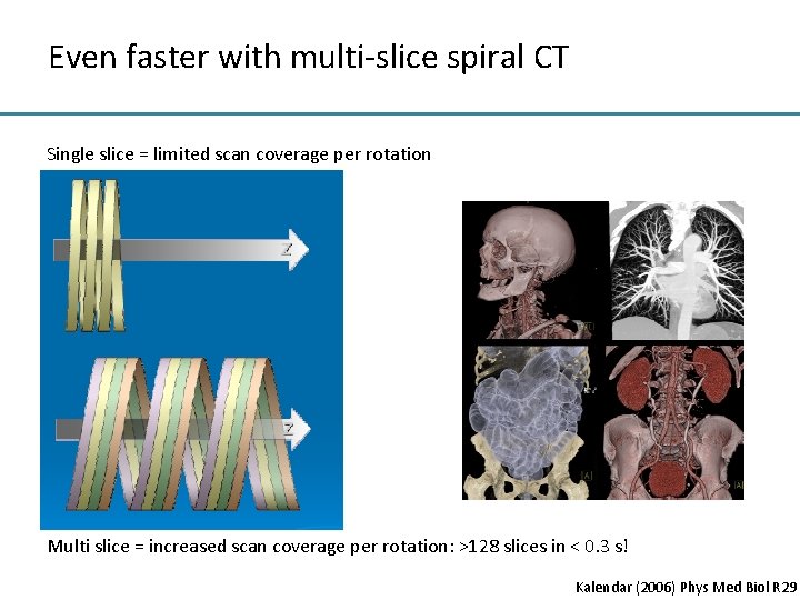 Even faster with multi-slice spiral CT Single slice = limited scan coverage per rotation