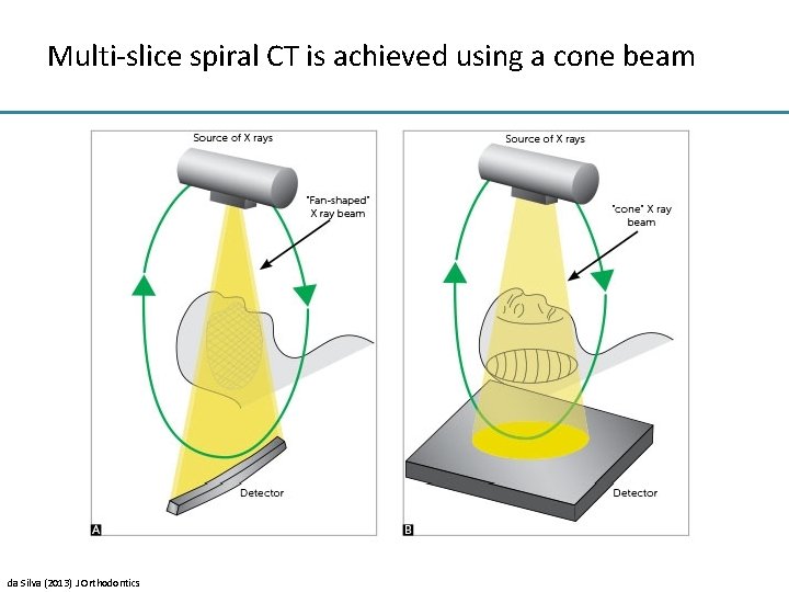 Multi-slice spiral CT is achieved using a cone beam da Silva (2013) J Orthodontics