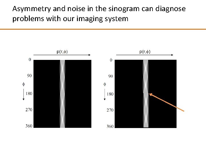 Asymmetry and noise in the sinogram can diagnose problems with our imaging system 