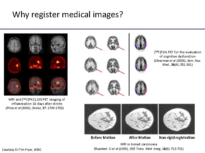 Why register medical images? [18 F]FDG PET for the evaluation of cognitive dysfunction (Silverman