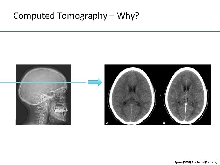 Computed Tomography – Why? Spann (2005) Eur Radiol (Siemens) 