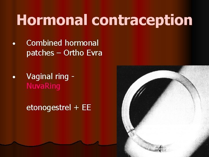 Hormonal contraception • Combined hormonal patches – Ortho Evra Vaginal ring - Nuva. Ring