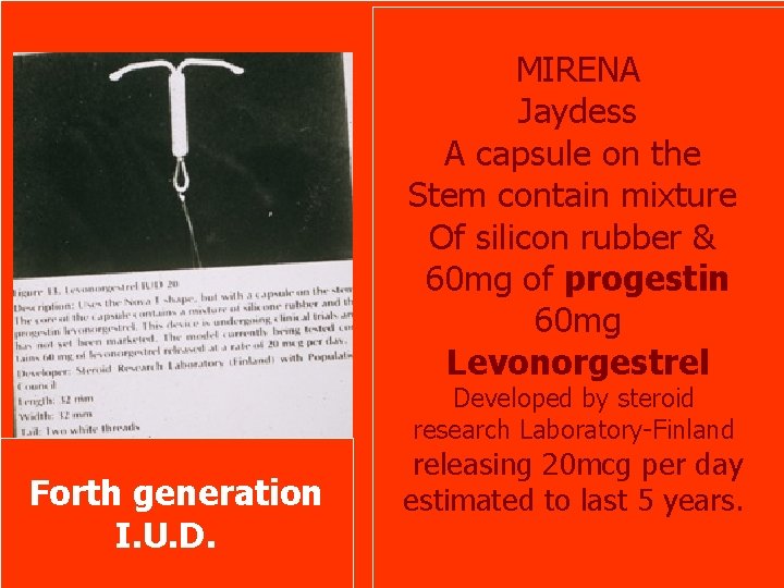 MIRENA Jaydess A capsule on the Stem contain mixture Of silicon rubber & 60