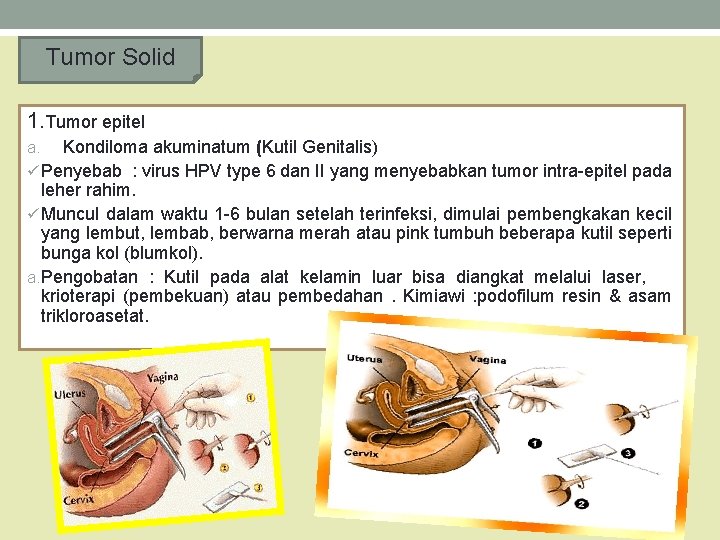 Tumor Solid 1. Tumor epitel Kondiloma akuminatum (Kutil Genitalis) ü Penyebab : virus HPV